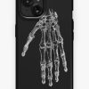 Redbubble Vintage Hand Anatomy Iphone Case Best