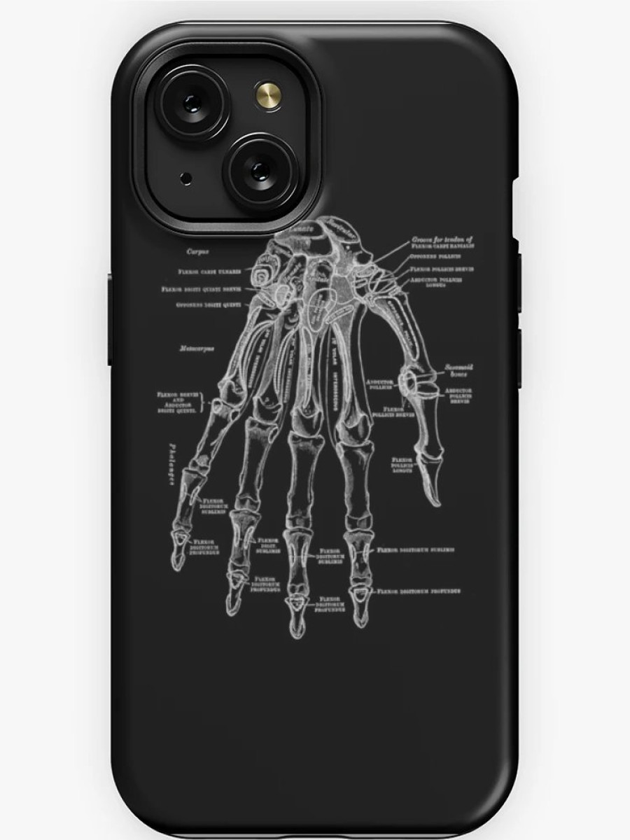 Redbubble Vintage Anatomical Hand Iphone Case Best